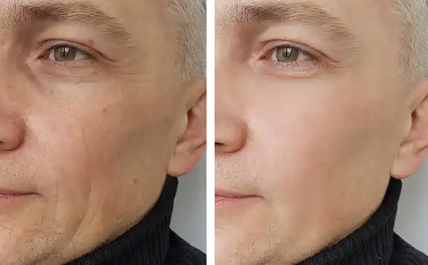 Before and after
